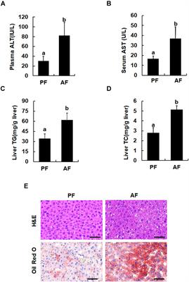 Hepatic SIRT3 Upregulation in Response to Chronic Alcohol Consumption Contributes to Alcoholic Liver Disease in Mice